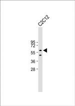 PAX7 Antibody in Western Blot (WB)