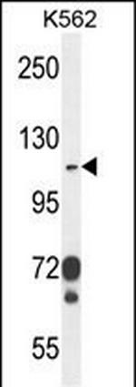 CD103 Antibody in Western Blot (WB)