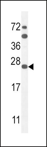 SCN1B Antibody in Western Blot (WB)