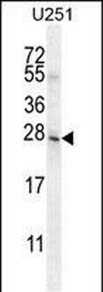 Mist1 Antibody in Western Blot (WB)