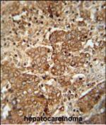 Serum Amyloid P Antibody in Immunohistochemistry (Paraffin) (IHC (P))