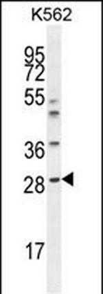 Serum Amyloid P Antibody in Western Blot (WB)