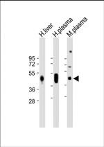 Haptoglobin Antibody in Western Blot (WB)