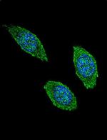 GM-CSF Antibody in Immunocytochemistry (ICC/IF)