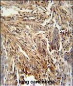 GM-CSF Antibody in Immunohistochemistry (Paraffin) (IHC (P))