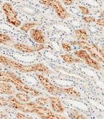 Folate Receptor alpha Antibody in Immunohistochemistry (Paraffin) (IHC (P))