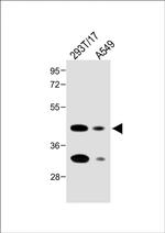 Folate Receptor alpha Antibody in Western Blot (WB)