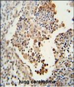 CADM1 Antibody in Immunohistochemistry (Paraffin) (IHC (P))