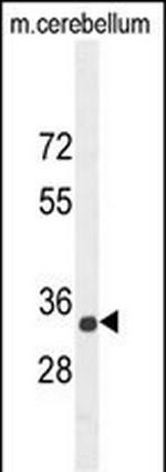 CADM1 Antibody in Western Blot (WB)