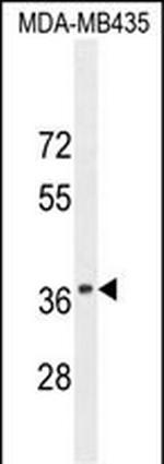 CADM1 Antibody in Western Blot (WB)