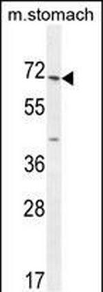 ESCO2 Antibody in Western Blot (WB)