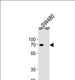 ETV5 Antibody in Western Blot (WB)