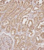 SERPINA6 Antibody in Immunohistochemistry (Paraffin) (IHC (P))