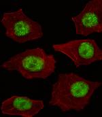 LMO4 Antibody in Immunocytochemistry (ICC/IF)