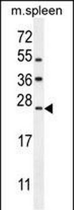 LMO4 Antibody in Western Blot (WB)