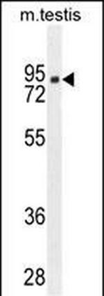 CLPX Antibody in Western Blot (WB)