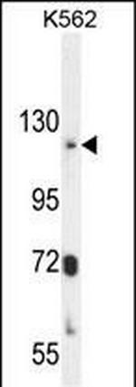 ATP8A2 Antibody in Western Blot (WB)