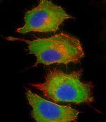 Complement Factor H Antibody in Immunocytochemistry (ICC/IF)