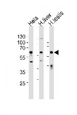 Apolipoprotein J Antibody in Western Blot (WB)