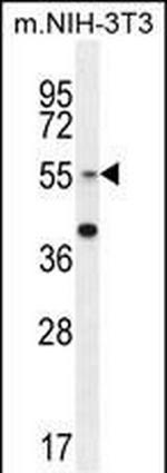 GCNT3 Antibody in Western Blot (WB)