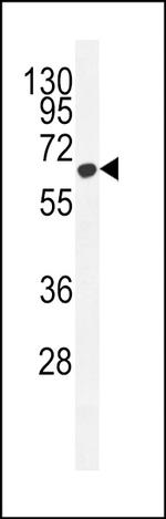 ZC3H12A Antibody in Western Blot (WB)