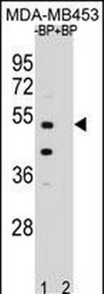 POC1B Antibody in Western Blot (WB)