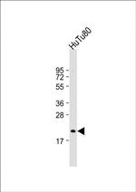 NUDT15 Antibody in Western Blot (WB)