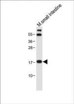 NUDT15 Antibody in Western Blot (WB)