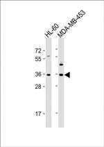 OR1J4 Antibody in Western Blot (WB)