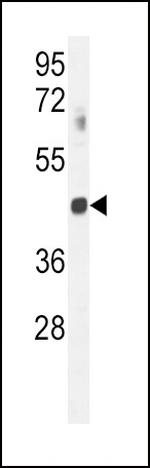 GNAT2 Antibody in Western Blot (WB)