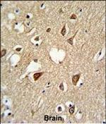 SUMO1 Antibody in Immunohistochemistry (Paraffin) (IHC (P))