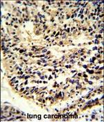 BCL2A1 Antibody in Immunohistochemistry (Paraffin) (IHC (P))