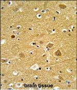 TNPO1 Antibody in Immunohistochemistry (Paraffin) (IHC (P))