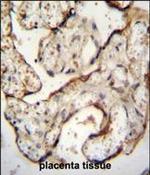 EGFR Antibody in Immunohistochemistry (Paraffin) (IHC (P))