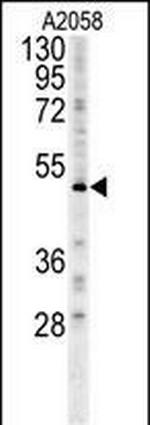 FOXC2 Antibody in Western Blot (WB)