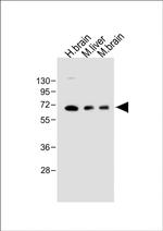 GLS2 Antibody in Western Blot (WB)