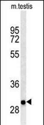 ITGB1BP3 Antibody in Western Blot (WB)