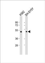 SMPD2 Antibody in Western Blot (WB)