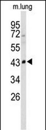 SMPD2 Antibody in Western Blot (WB)