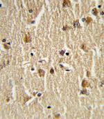 HSC70 Antibody in Immunohistochemistry (Paraffin) (IHC (P))