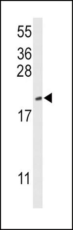 Cofilin Antibody in Western Blot (WB)