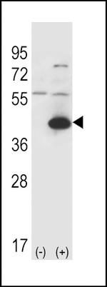 GOT1 Antibody in Western Blot (WB)