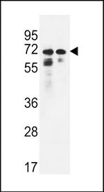 PNPLA8 Antibody in Western Blot (WB)