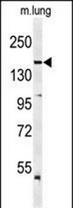 VEGF Receptor 2 Antibody in Western Blot (WB)