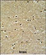 BHLHB5 Antibody in Immunohistochemistry (Paraffin) (IHC (P))