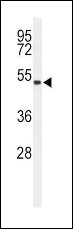 ASMT Antibody in Western Blot (WB)