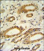 DDO Antibody in Immunohistochemistry (Paraffin) (IHC (P))