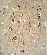 FA2H Antibody in Immunohistochemistry (Paraffin) (IHC (P))