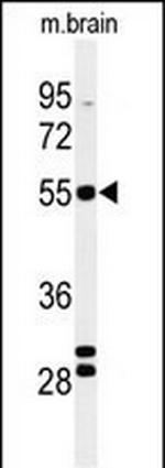 FA2H Antibody in Western Blot (WB)