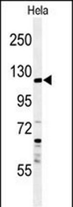 SYTL2 Antibody in Western Blot (WB)